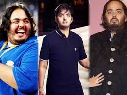 anant ambani weight loss